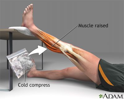 How to Recover from a Sprain or Muscle Strain
